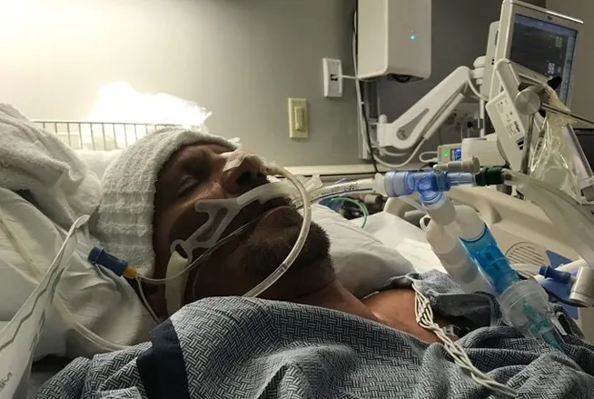 Greg R. Traver on a ventilator in a hospital ICU bed in 2017, before learning to live with congestive heart failure
